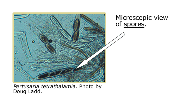 microscopic view of Pertusaria tetrathalamia spores.